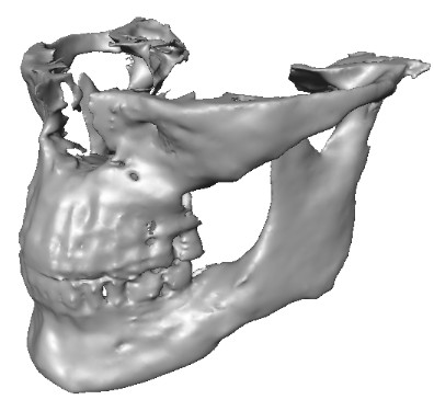 Example of a digital 3D anatomical model